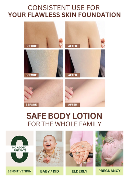 SUBSCRIPTION | Lotion (98 ML) | The Health Yard